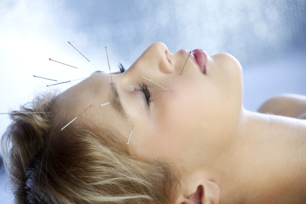 Akupunktur am Kopf